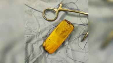 الهاتف بعد استخراجه