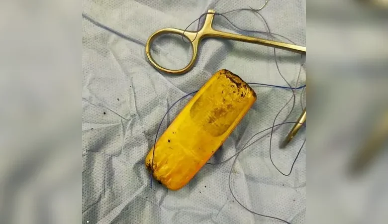 الهاتف بعد استخراجه