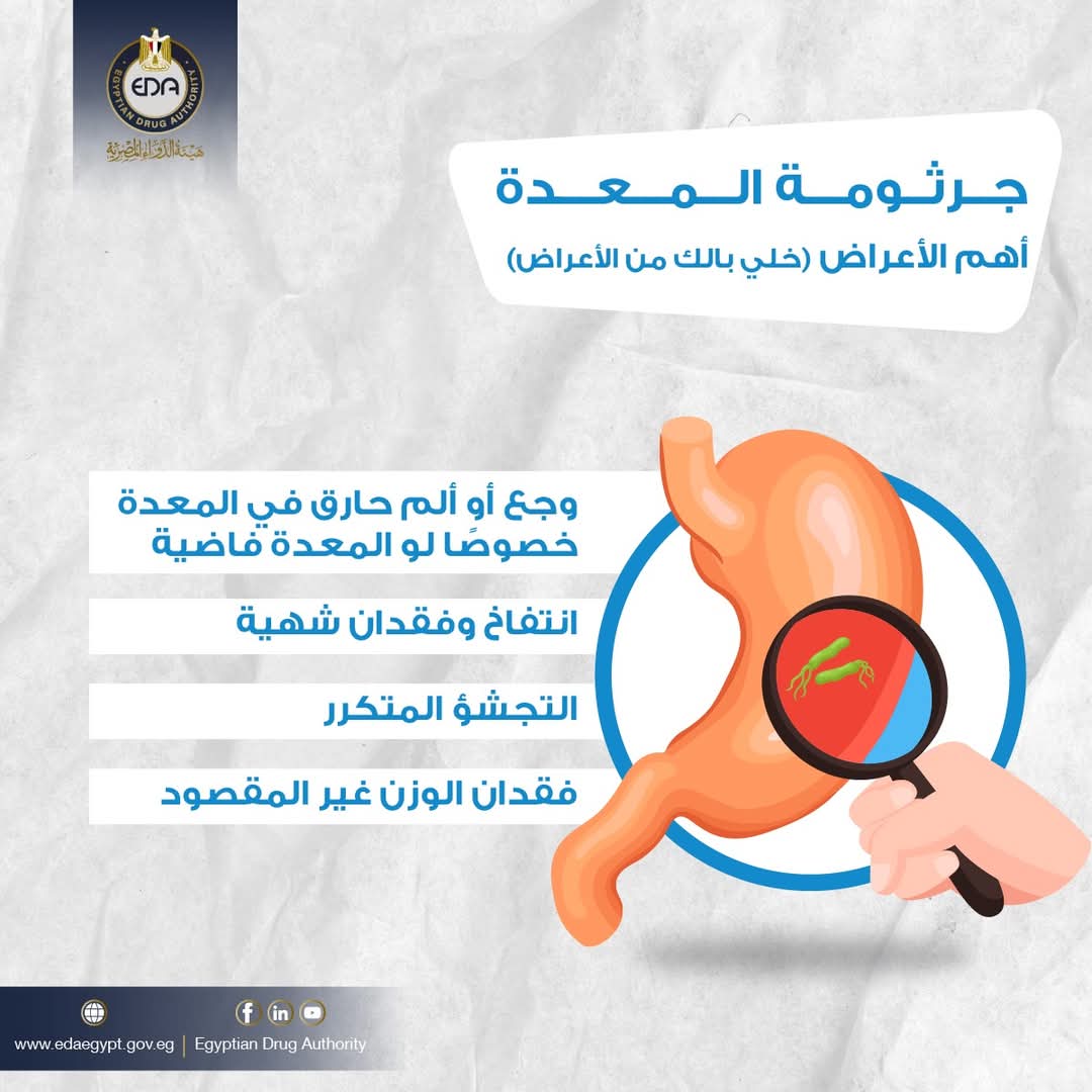 تعرف على جرثومة المعدة.. الأسباب والأعراض وطرق الوقاية