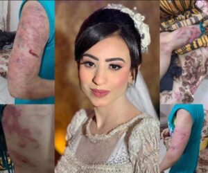 مأساة عروسة يتيمة في بني سويف: 8 ساعات من التعذيب على يد زوجها