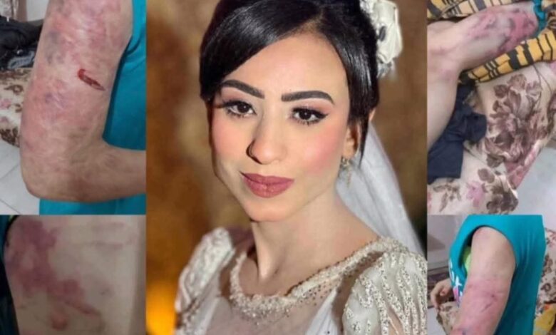 مأساة عروسة يتيمة في بني سويف: 8 ساعات من التعذيب على يد زوجها