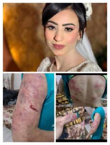 مهرائيل ضحية العنف الزوجي