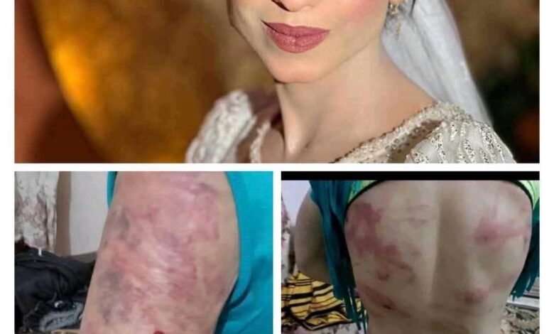 مهرائيل ضحية العنف الزوجي