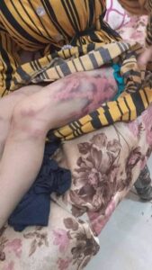 مهرائيل ضحية العنف الزوجي