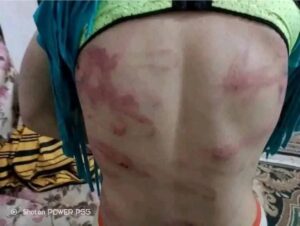 مهرائيل ضحية العنف الزوجي