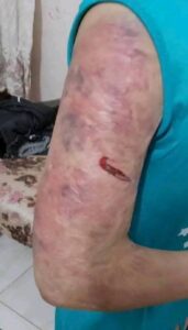 مهرائيل ضحية العنف الزوجي