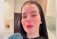 دنيا فؤاد صاحبة واقعة التبرع